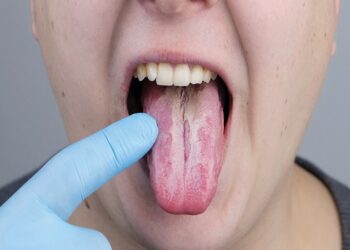 Tongue Disease: आजाराचं लक्षण ठरतं जिभेवरील पांढरा थर, ‘या’ 7 घरगुती उपायांनी जीभ करा स्वच्छ